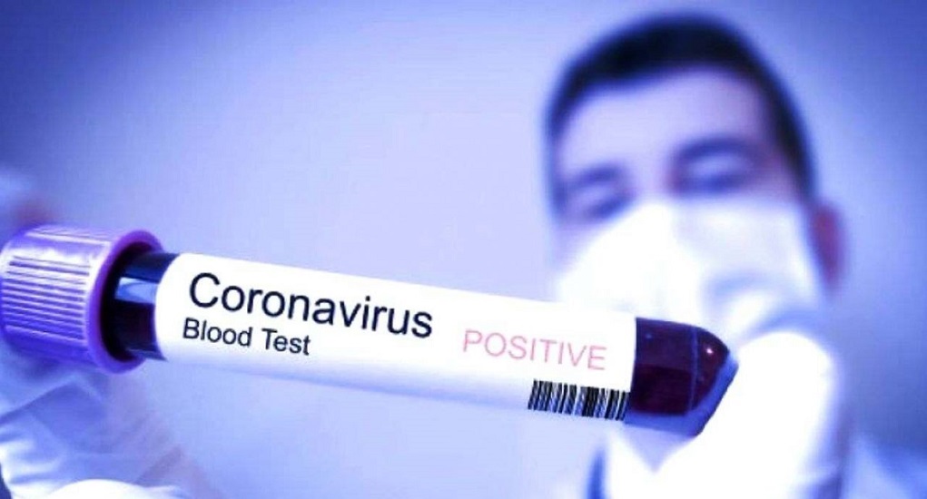 6 Cara Efektif untuk Mencegah Penularan Virus Corona