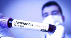 Benarkah Virus Corona Mudah Menular
